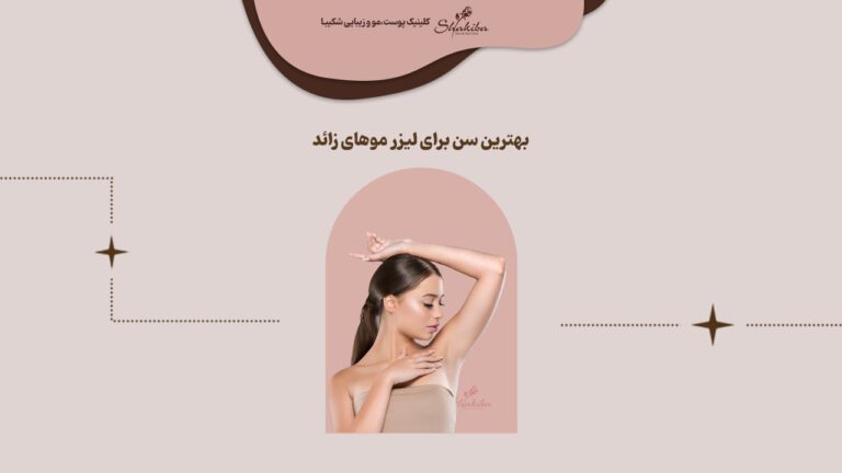 بهترین سن برای لیزر موهای زائد
