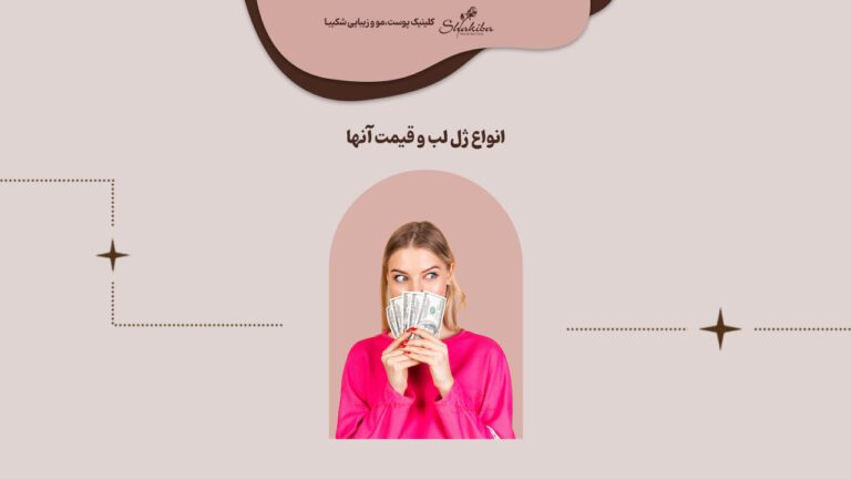 انواع ژل لب