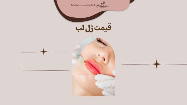 قیمت ژل لب 1402