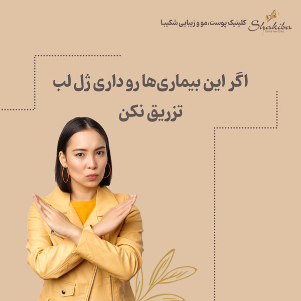 عوارض تزریق ژل لب