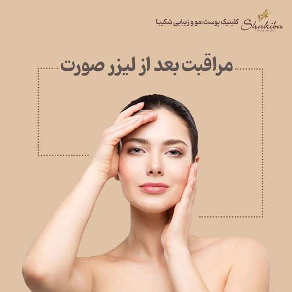 مراقبت بعد از لیزر صورت