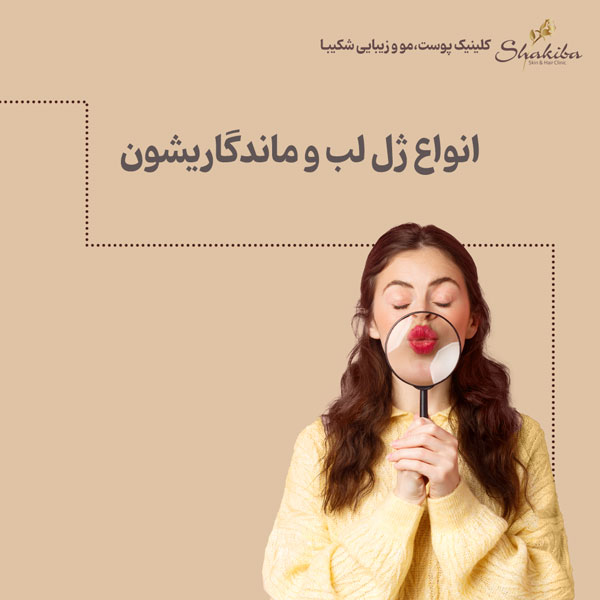 انواع ژل لب و ماندگاریشون