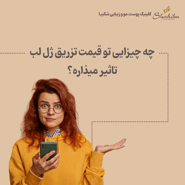قیمت ژل لب