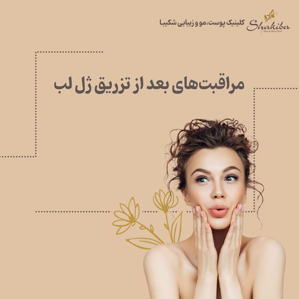 مراقبت‌های بعد از تزریق ژل لب