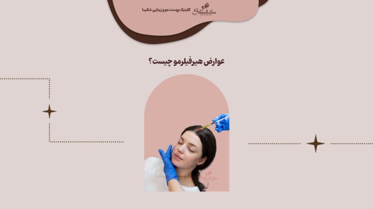 عوارض فیلر مو چیست