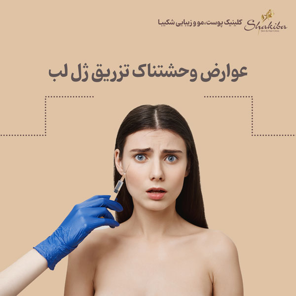 عوارض وحشتناک تزریق ژل لب
