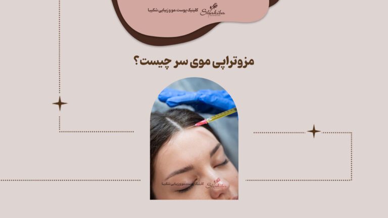 مزوتراپی مو ی سر چیست