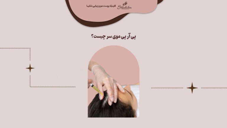 پی آر پی مو چیست