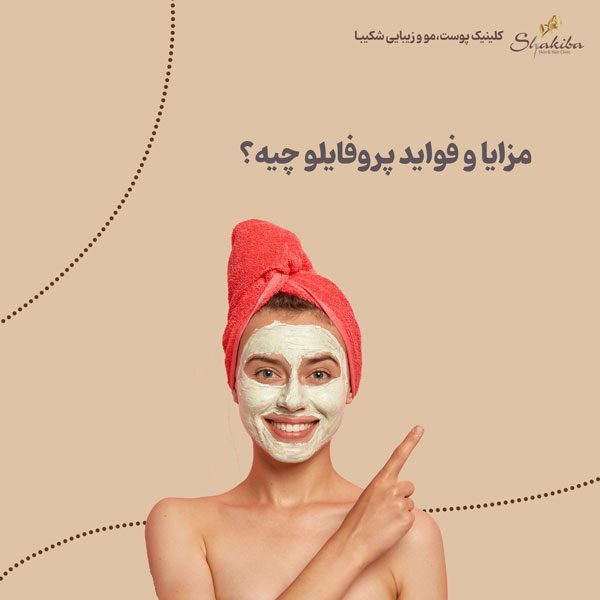 مزایا و فواید پروفایلو چیست