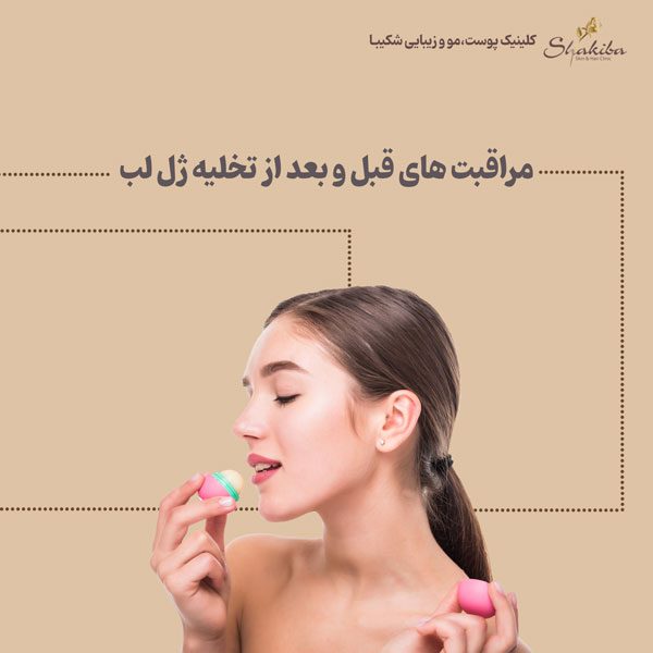 مراقبت های قبل و بعد از تخلیه ژل لب