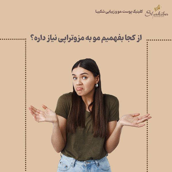 مزوتراپی مو 