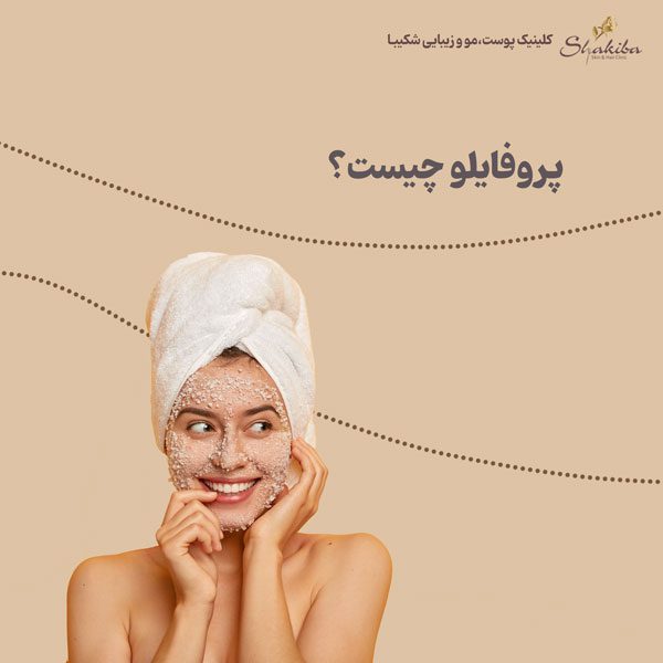 پروفایلو چیست
