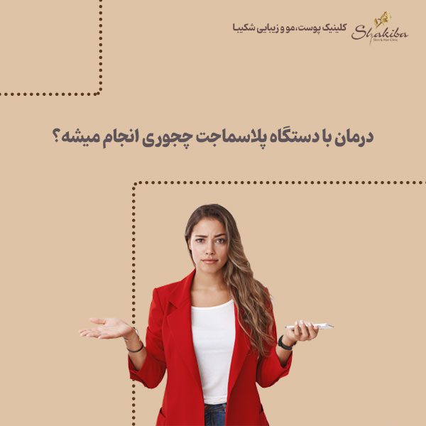 نحوه درمان با دستگاه پلاسما جت