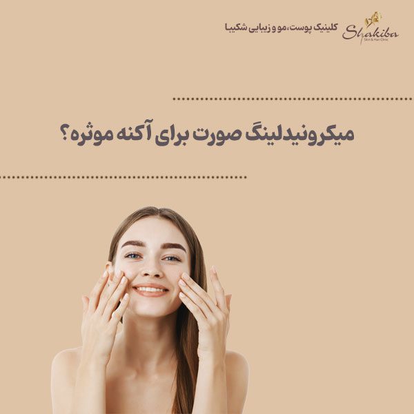 میکرونیدلینگ صورت برای آکنه 
