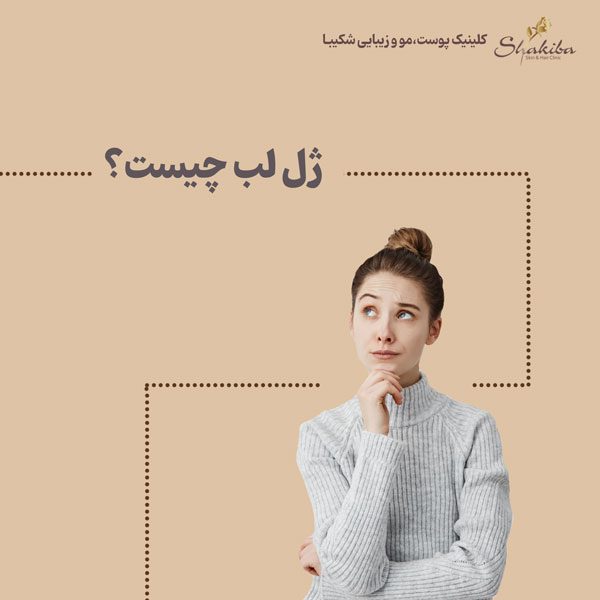 ژل لب چیست؟
