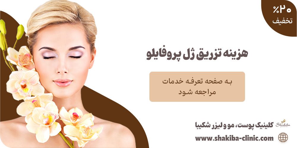 هزینه تزریق ژل پروفایلو