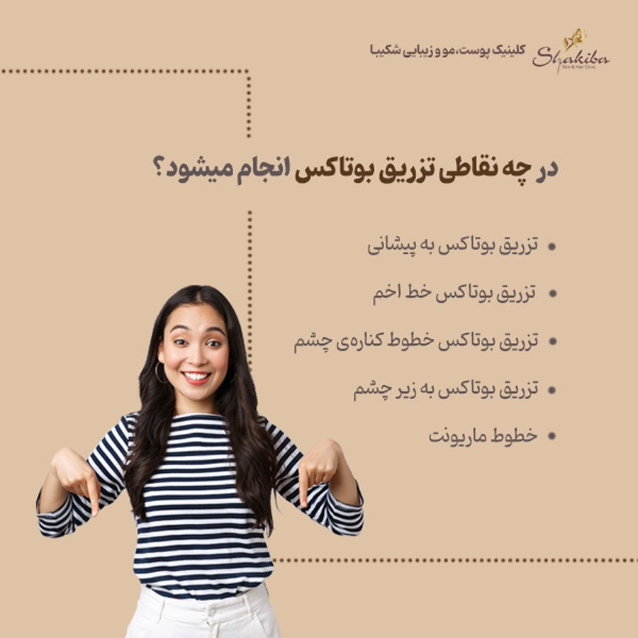 نقاط تزریق بوتاکس