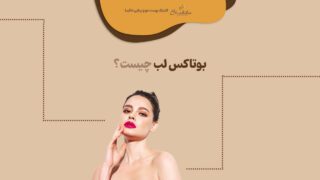 بوتاکس لب چیست
