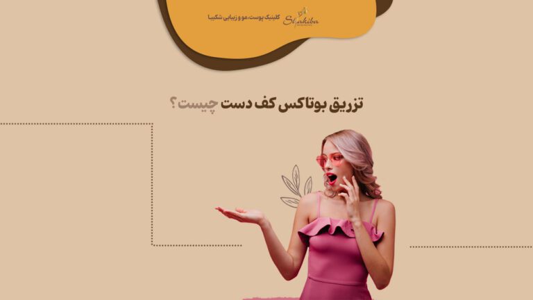 بوتاکس کف دست