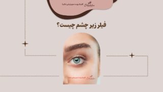 فیلر زیر چشم چیست