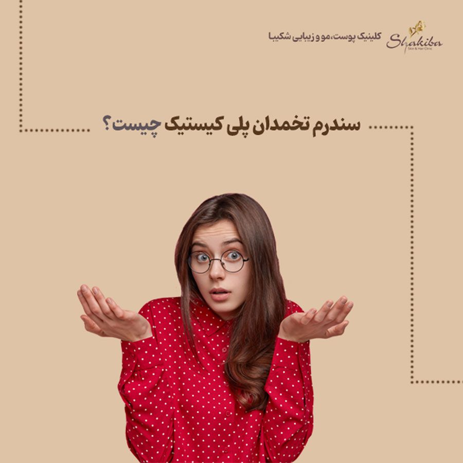 سندرم تخمدان پلی کیستیک و لیزر موهای زائد