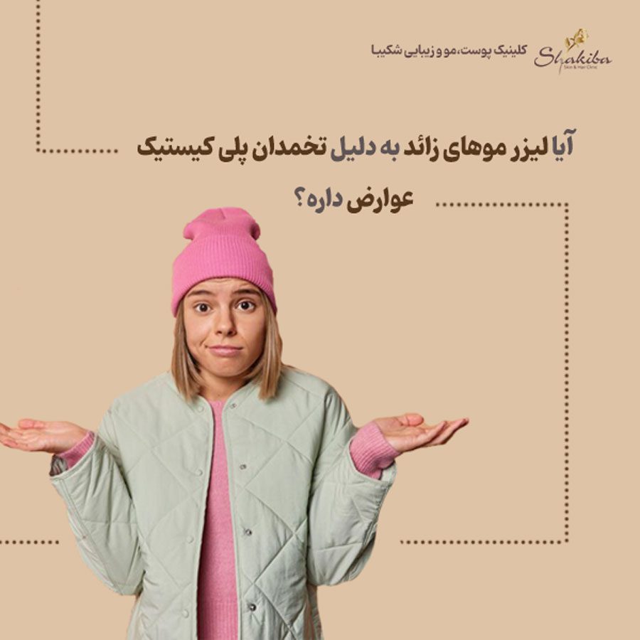 لیزر موهای زائد برای سندرم تخمدان پلی کیستیک
