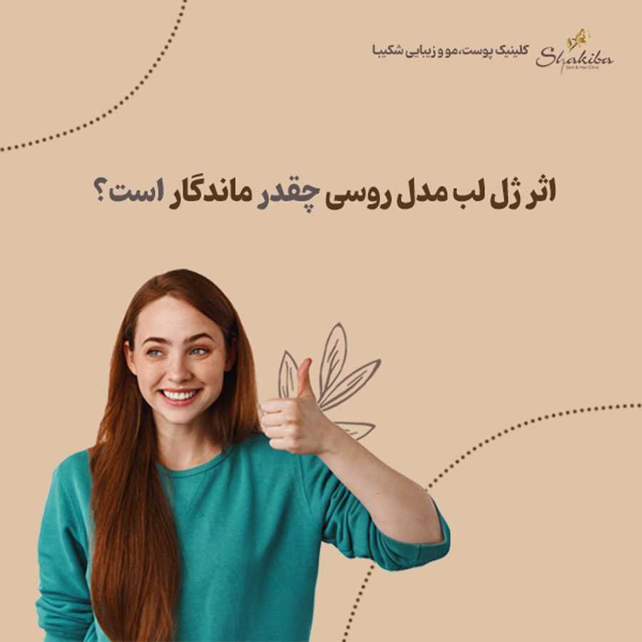 ماندگاری ژل لب مدل روسی