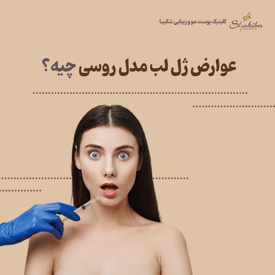 عوارض ژل لب مدل روسی