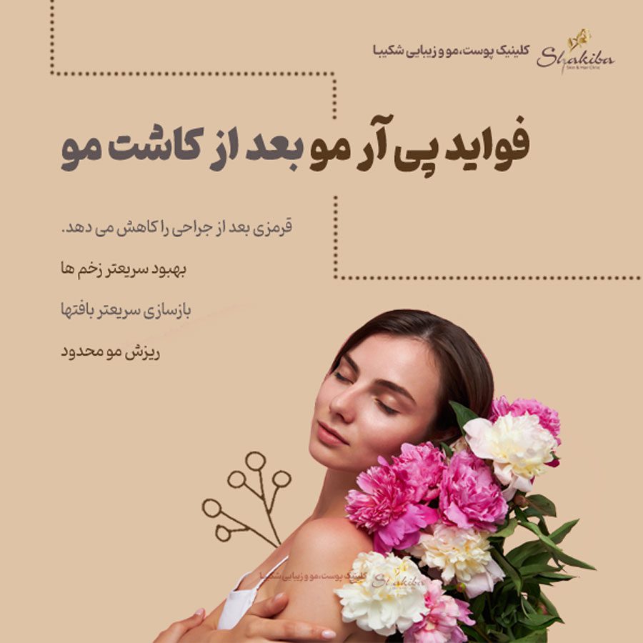 فواید پی آر پی مو