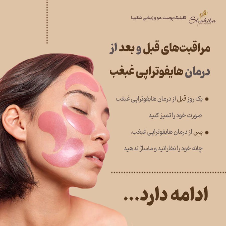 هایفوتراپی غبغب