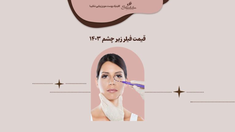 هزینه تزریق فیلر زیر چشم