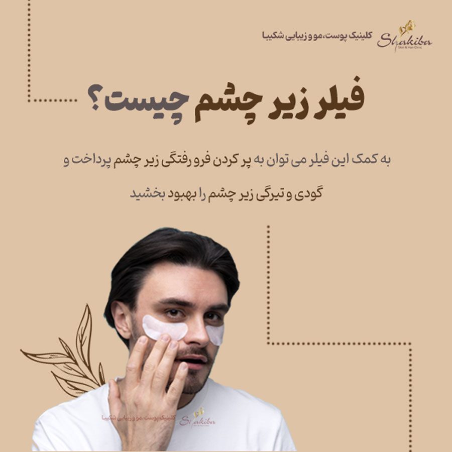 فیلر زیر چشم