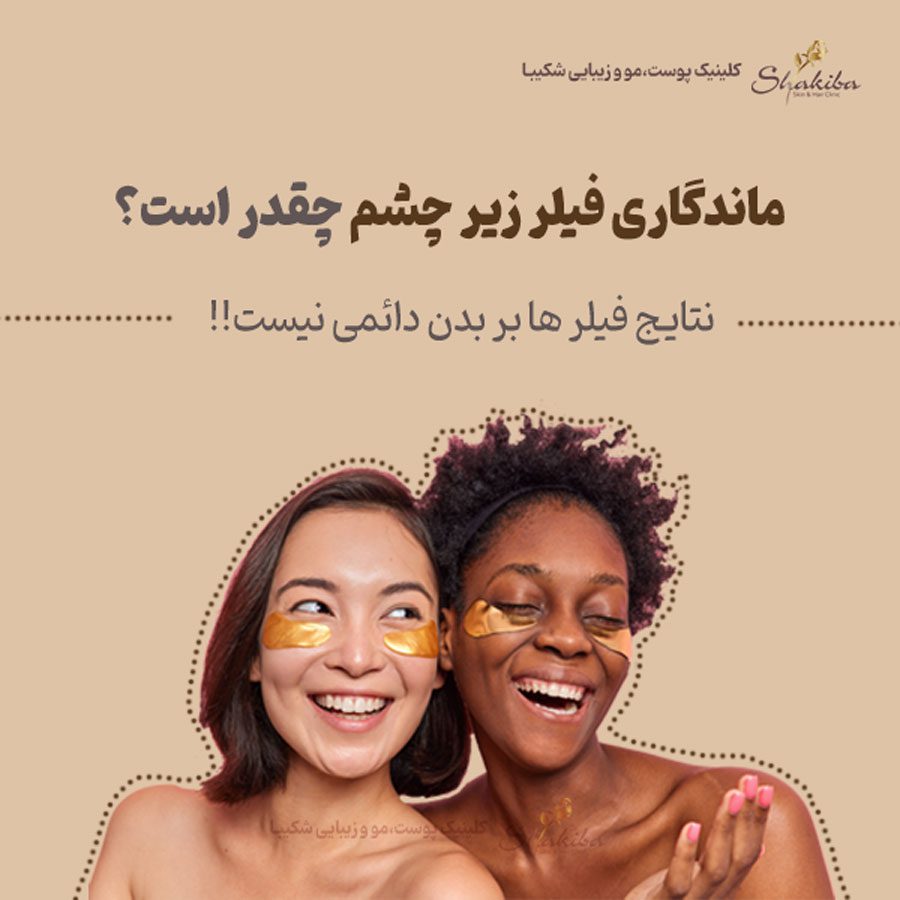 ماندگاری فیلر زیر چشم
