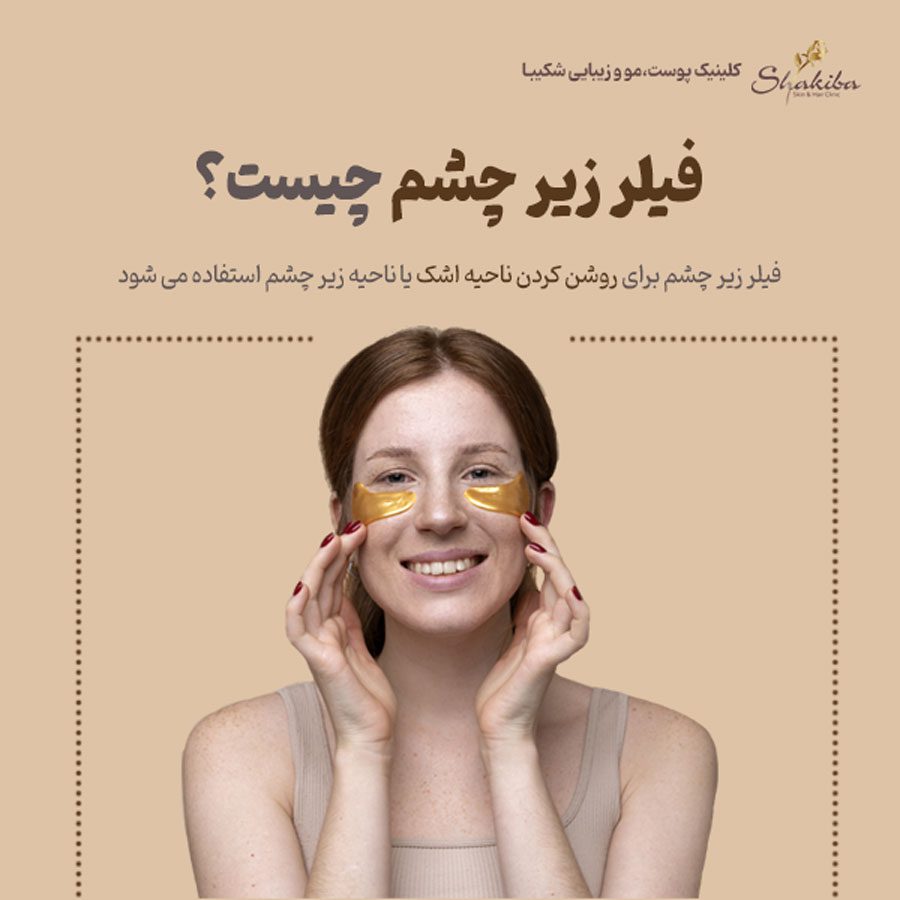 فیلر زیر چشم