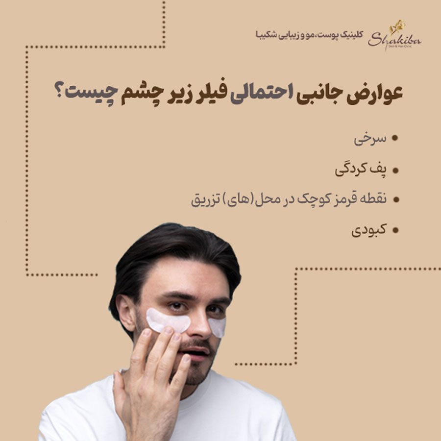 عوارض فیلر زیر چشم