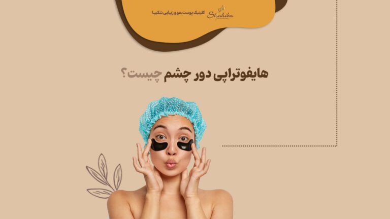هایفوتراپی دور چشم