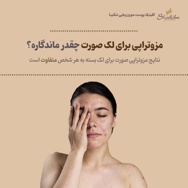 مزوتراپی برای لک صورت