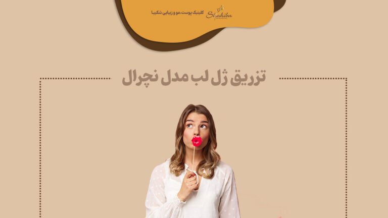تزریق ژل لب مدل نچرال