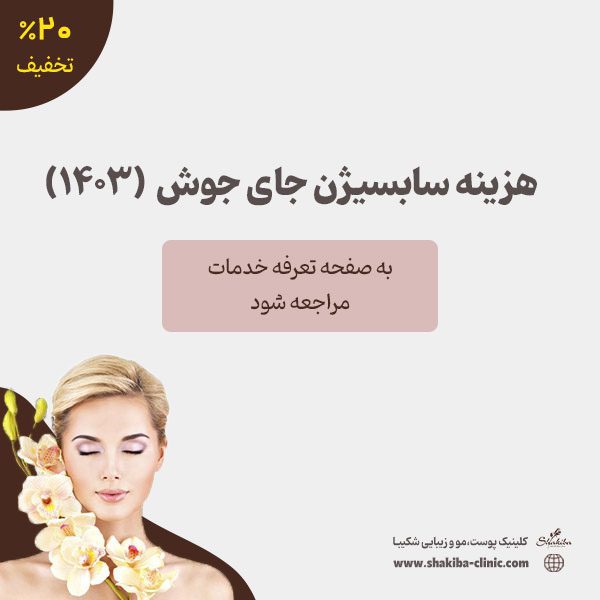 هزینه سابسیژن جای جوش