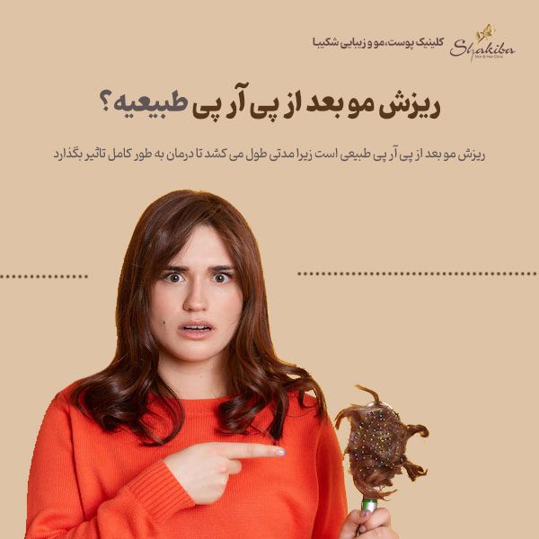 علت ریزش مو بعد از پی آر پی