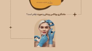 ماندگاری بوتاکس پیشانی و صورت