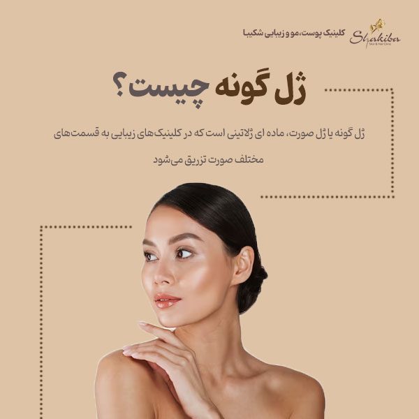ژل گونه چیست