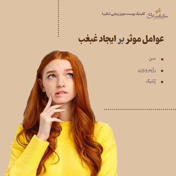 عوامل موثر بر ایجاد غبغب