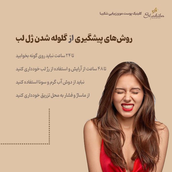 گلوله شدن ژل لب