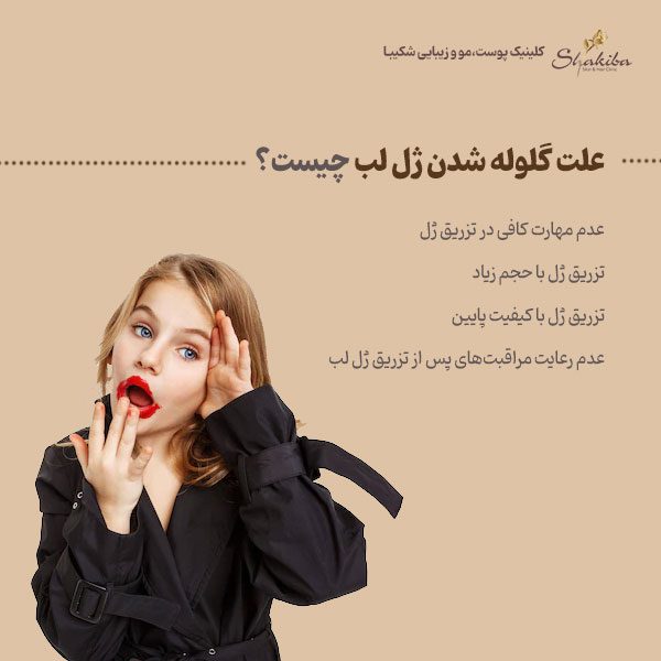 علت گلوله شدن ژل لب