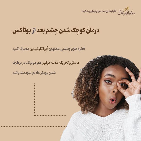 درمان کوچک شدن چشم بعد از بوتاکس