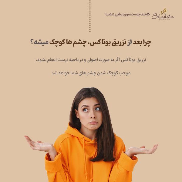 کوچک شدن چشم در اثر بوتاکس