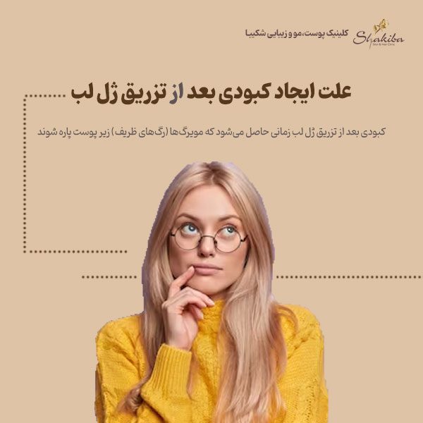 علت ایجاد کبودی بعد از تزریق ژل لب