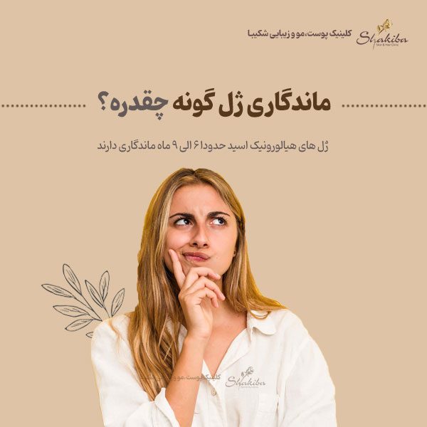 ماندگاری ژل گونه