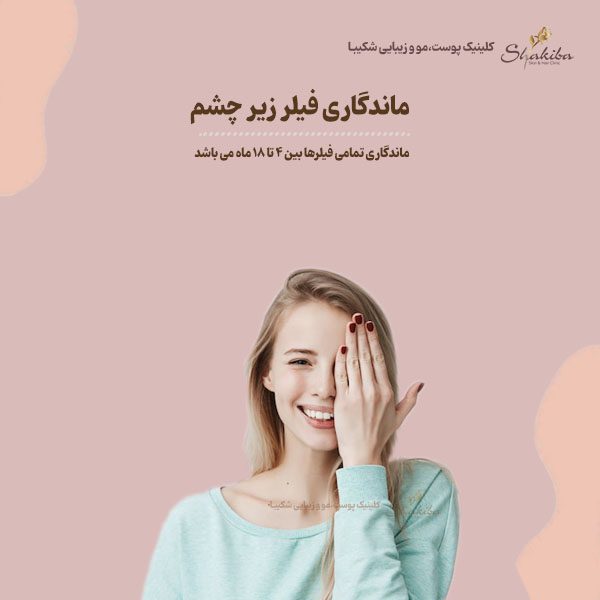 ماندگاری فیلر زیر چشم